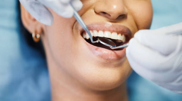 Best Emergency Denture Repair in Middlesex, NJ