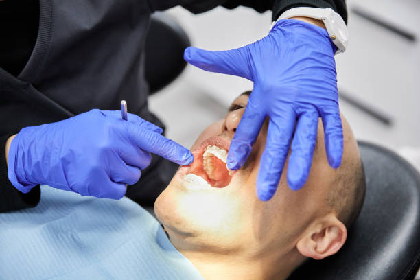 Best Emergency Root Canal Therapy in Middlesex, NJ